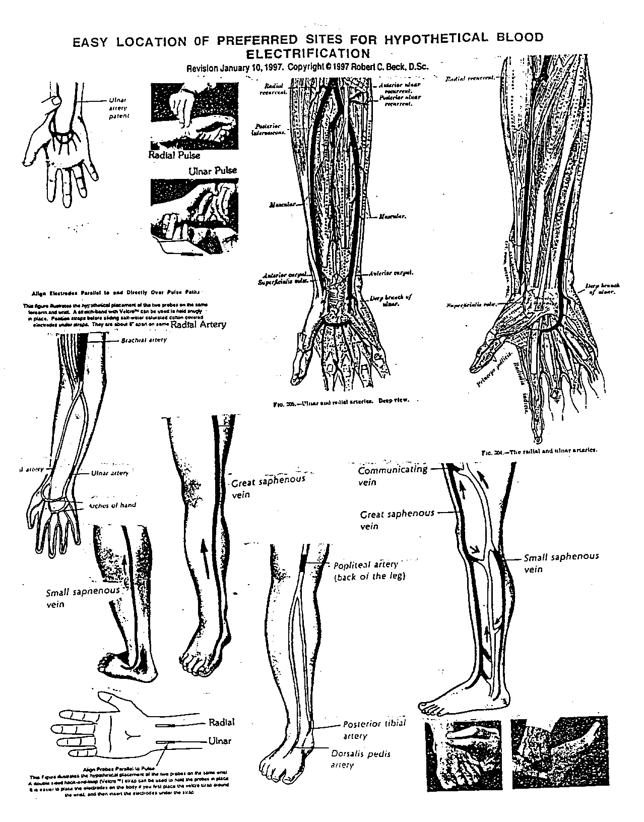 Blood Electrification Sites