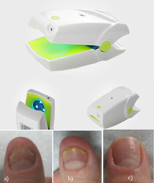 Nail Laser